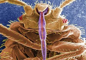 A bed bugs face and front under an electron-microscope